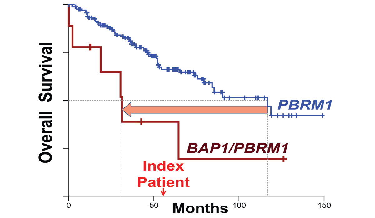 Sam_PenaLlopis's tweet photo. 9/10. The complete #BAP1 loss decreased fourfold the expected patient survival. Hence, #synonymous #mutations identified in #CancerGenomics and #PrecisionMedicine should not be systematically discarded but carefully analyzed in #CancerGenes, especially near acceptor splice sites https://t.co/E68AoAfREc