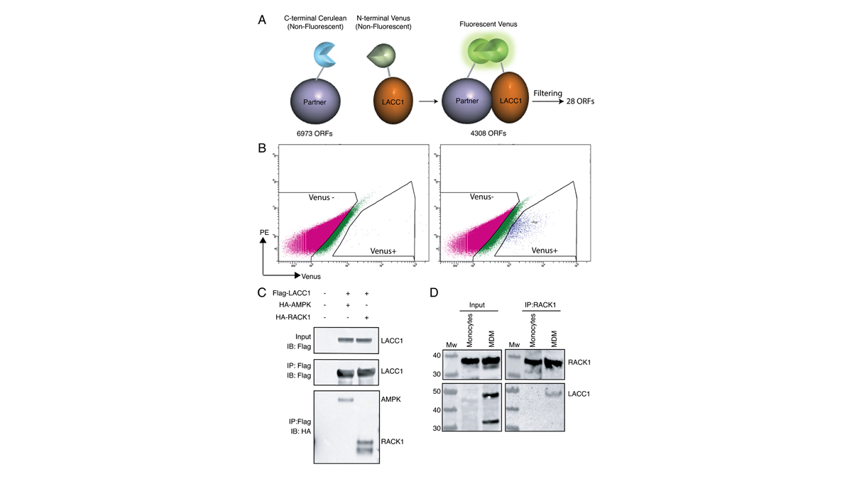 Journal of Experimental Medicine (@jexpmed) on Twitter photo LACC1 deficiency has been identified as a monogenic cause of juvenile arthritis. In this study, <a href="/OmarjeeOmmar/">Ommar Omarjee</a>, <a href="/AlexandreBelot/">Belot Alexandre</a>, <a href="/lyacts/">LYACTS-CIRI</a> and colleagues demonstrate a new role of LACC1 in #autophagy and metabolism in #macrophages.
bit.ly/2NeeQG0
#Innateimmunity LACC1 deficiency has been identified as a monogenic cause of juvenile arthritis. In this study, <a href="/OmarjeeOmmar/">Ommar Omarjee</a>, <a href="/AlexandreBelot/">Belot Alexandre</a>, <a href="/lyacts/">LYACTS-CIRI</a> and colleagues demonstrate a new role of LACC1 in #autophagy and metabolism in #macrophages.
bit.ly/2NeeQG0
#Innateimmunity