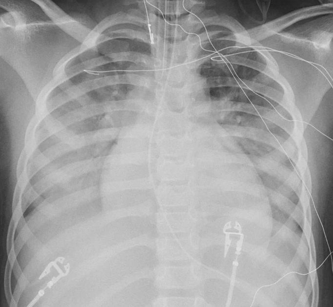 Pediatric Radiology tweet media