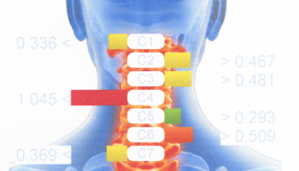 spoon_central's tweet image. Check this out! I got thermal imaging of my spine today to measure the level of inflammation. For reference, green is good and red is bad. I can&apos;t wait to get the results of my digital motion x-ray on Monday! #Diagnostic #nerveproblems