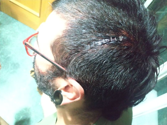 outsidersesp's tweet photo. El periodista @IvhanGavilan fue agredido ayer en Valencia durante las cargas policiales. 

No pueden pegar de cintura para arriba, pero aun así le abrieron la cabeza. Porque las leyes son suyas. https://t.co/XFMaRIzmTf