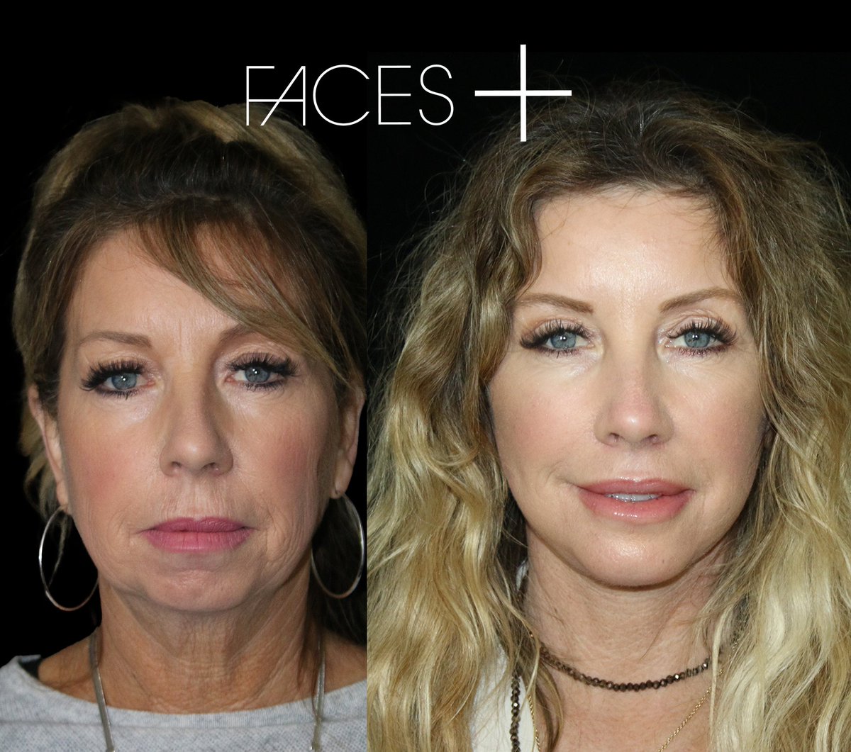 Facesplus tweet media