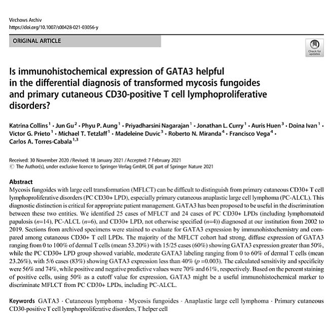 We are excited to announce our latest #research!! Is #GATA3 helpful in the diffdx of transformed mycosis fungoides and primary cutaneous CD30-positive T cell LPD? Published  in Virchows Archiv (<a href="/SpringerNature/">Springer Nature</a>) Congrats to all 🥳🎊
Read the full text here: rdcu.be/cftYt