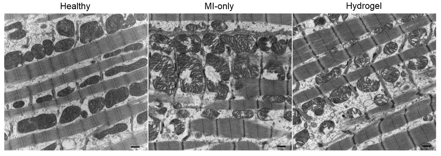 Scientists at @nuigalway have created an injectable hydrogel that improves heart function, reduces tissue damage, and encourages the regrowth of blood vessels in a sheep model of #HeartAttack. fcld.ly/vqkn7dh