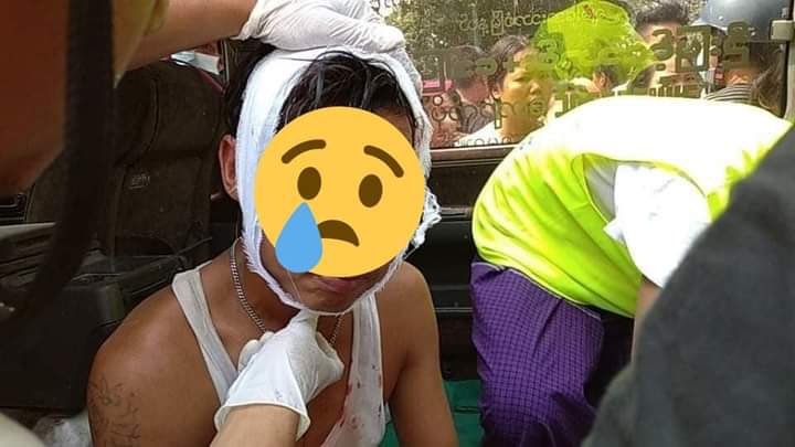 Winnie80820320's tweet photo. In Mandalay,the military came by force to pressure the civil servants to go back to work!Police fired the guns into crowd for more than 20 times with rubber bullet. One got injuries by the head and one got shot by the thigh for three times.
#Feb20Coup 
#WhatsHappeningInMyanmar https://t.co/HMz31BRZDv