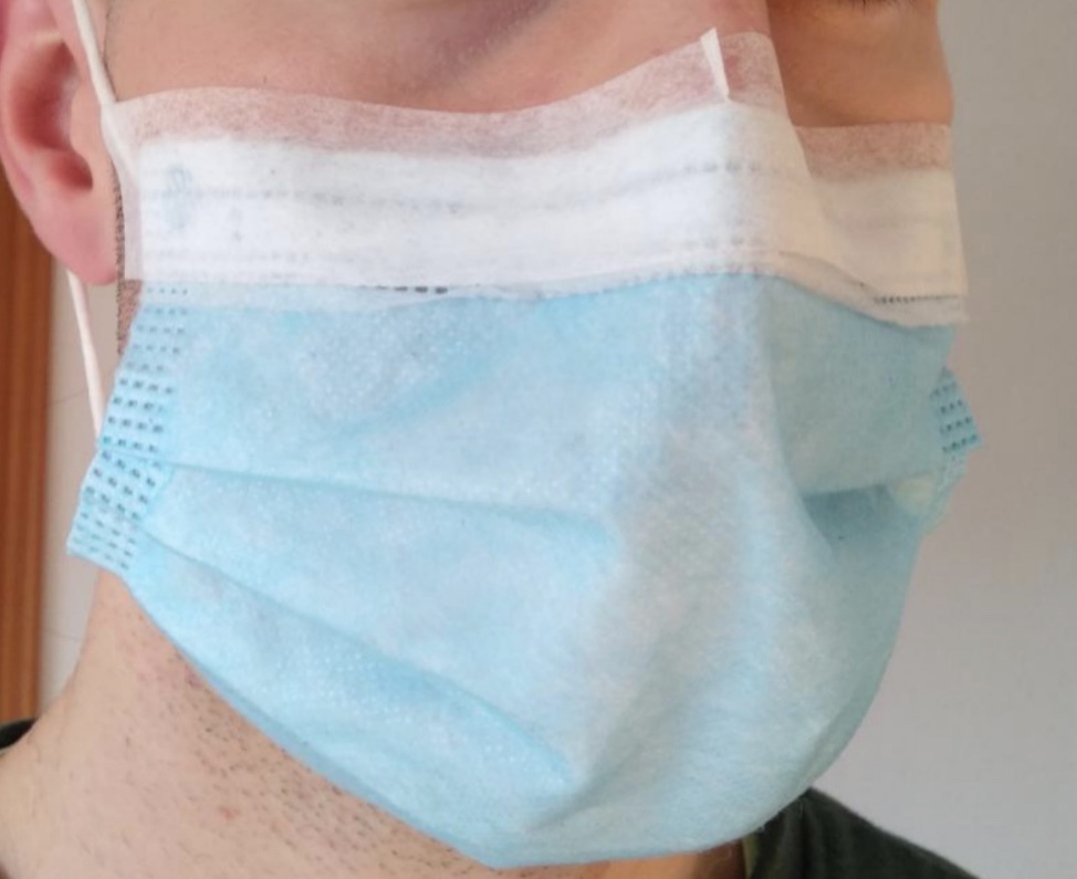 Unfitted face masks can simulate visual field progression in ~6% of tests, mainly inferior hemifield &amp; increased fixation losses. Use a surgical mask with an adhesive tape covering the superior border may reduce mask-related artefacts! ow.ly/kIHI30rxG8z #GlaucomaMonitoring