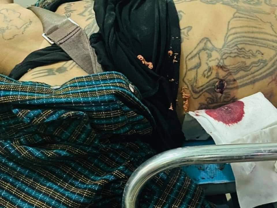 Mapel17682321's tweet photo. Mandalay is in danger! Soliders are killing citizens by firing! 50 r in emergency and 2 were dead. One was shot in head and the other was shot in abdomen. How many lives do we need to lose to gain Democracy? 
SUPPORT CRPH
#Feb20Coup
#WhatsHappeningInMyanmar https://t.co/QXTbcimKrt