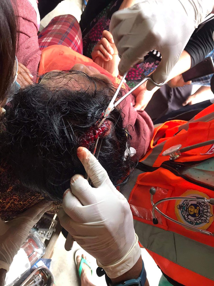 Maythet_ko's tweet photo. Myanmar military brutally cracked down on peaceful protestors with 6 reported deaths. Their crimes against humanity are being ignored by China, Russia, ASEAN &amp; InternationalCommunities.@Trevornoah @AC360
@ckoettl @PressSec @WhiteHouse
#CrimesAgainstHumanity 
#myanmarmilitarycoup https://t.co/5K1OBXU2zq