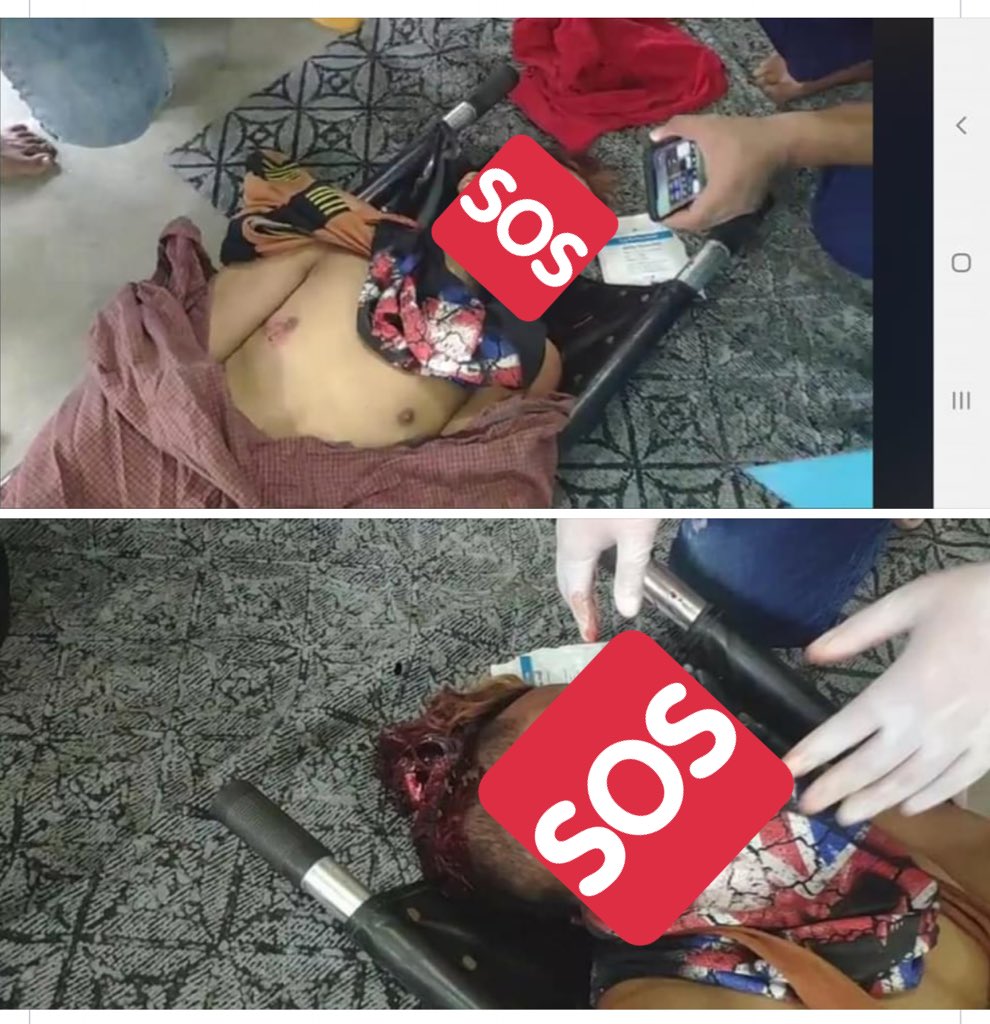 tw // blood , wound , death

MYANMAR MILITARY IS A MURDERER

Currently there are two dead cases and a lot of injured civilians who got shot by the military with real bullets.
<a href="/POTUS/">President Donald J. Trump</a> <a href="/UN/">United Nations</a> <a href="/SchranerBurgen1/">Christine Schraner Burgener</a> <a href="/RapporteurUn/">UN Special Rapporteur Tom Andrews</a> <a href="/UNinMyanmar/">United Nations in Myanmar</a> 
#WhatsHappeningInMyanmar 
#Feb20Coup