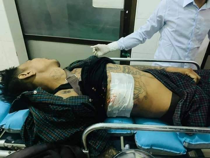 This case took place in Mandalay.
A man's head touched when soldier shot the peaceful protesters.
Myanmar military coup is breaking our human rights. I can't accept that case.
#WhatIsHappeningInMyanmar 
#Feb20Coup