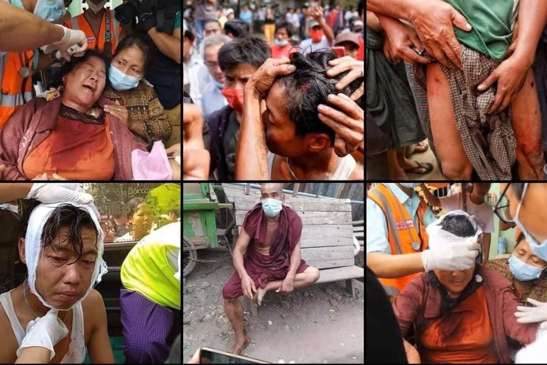 BunnyPhyoe's tweet photo. tw // blood , wound 
Today in Mandalay, Myanmar. 
#WhatsHappeningInMyanmar 
#Feb20Coup https://t.co/mMnhaRdUAk