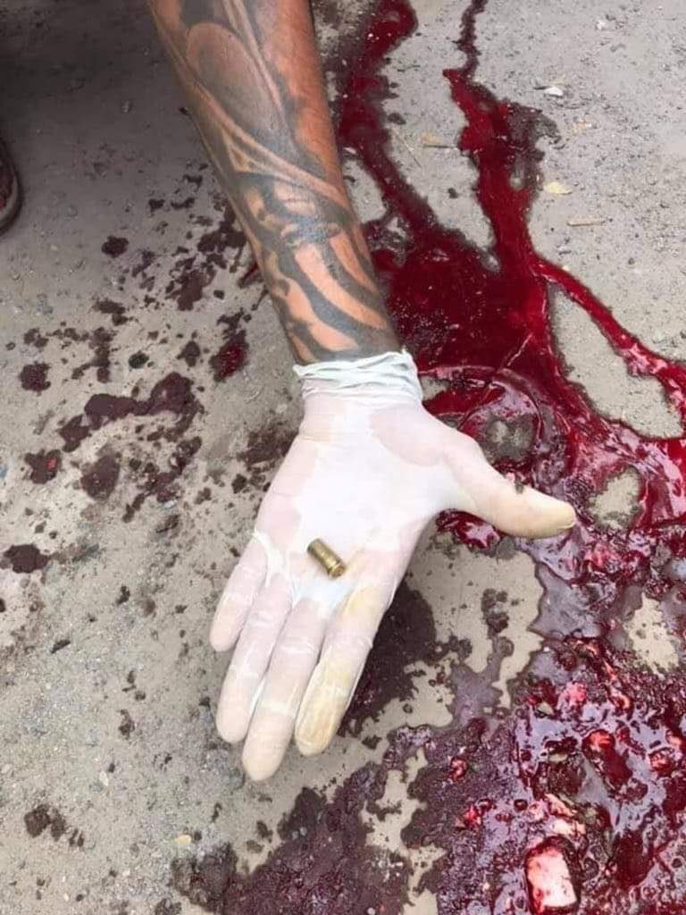 TW: Gunshot/Wound/Blood/Death/Bullet

A 10 years old kid got shot in the head to death and the bullet went through his skull and right through the brain. 
#WhatsHappeningInMyanmar 
#Feb20Coup