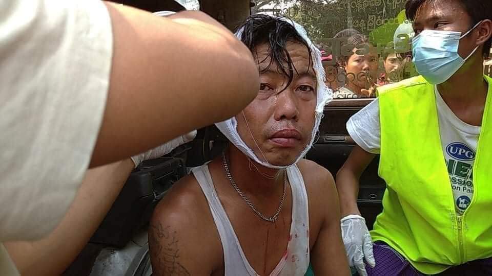It's is just now happening in Mandalay 41th street. Police shoot with the guns the people who protest peacefully. They shoot about 15points and two people were injured. They are very rude day by day. Save Myanmar and save our lives. 

#WhatsHappeningInMyanmar 
#Feb20Coup