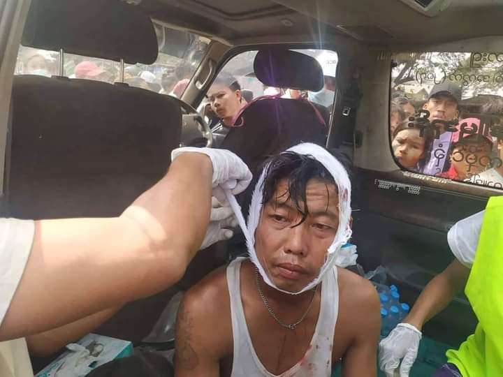 This is what Military is doing to our people!
Where is Justice for us?
Where is our Freedom?
We want Democracy!
tw//blood

#WhatsHappeninglnMyanmar 
#Feb20Coup