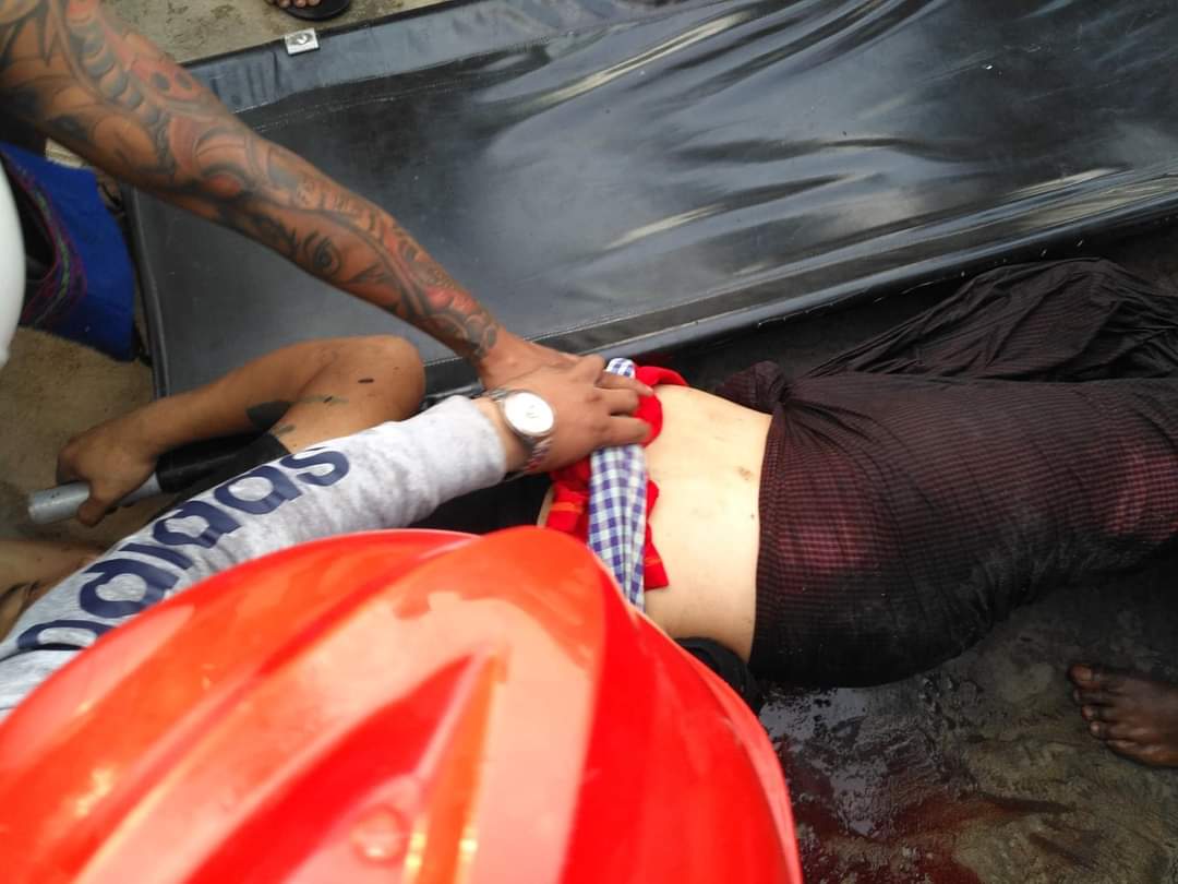 TW//blood
A person from Mandalay was shot by a real bullet

The situation is worrying ....
#Feb20Coup 
#WhatsHappeningInMyanmar