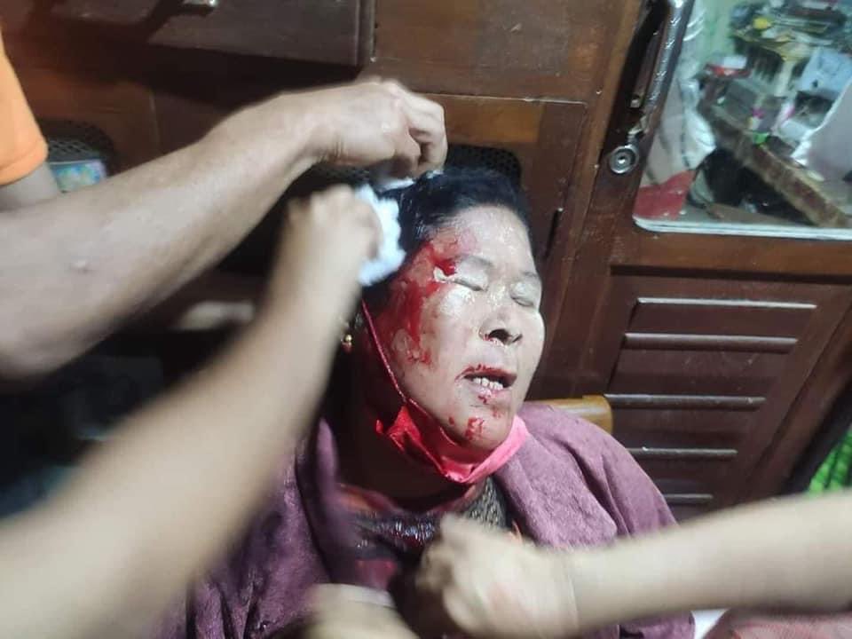Military is shooting people with Guns. Save Myanmar. Please Save Us #WhatsHappeningInMyanmar #Feb20Coup #RejectTheMilitary #SaveMyammar