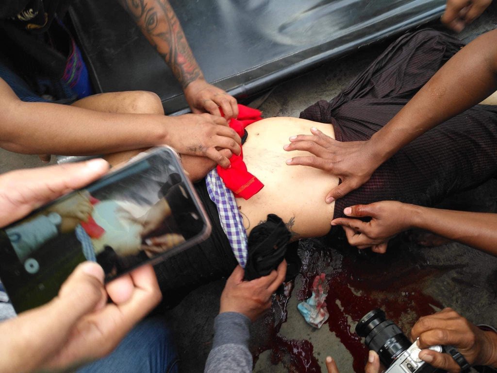 htetmyatthadar's tweet photo. A person from Mandalay was hit by a real bullet
 The front and back of the abdomen bulge
 The situation is worrying .....

 4:10 PM

 #FightForDemocracy
 #RejectMilitaryCoup
 #givebbackourfreedom https://t.co/sZ2tOO8SXn