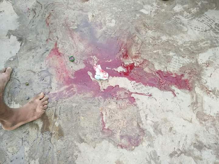 UPDATE
Blood, Gun Shot
Just happened in Mandalay, the police shot with gun to the crowd and this protestor is critically injured.
Still not confirm the gun is rubber or live gun. According to the patient, the gun must be live gun.
SUPPORT CRPH
#WhatsHappeningInMyanmar
#Feb20Coup
