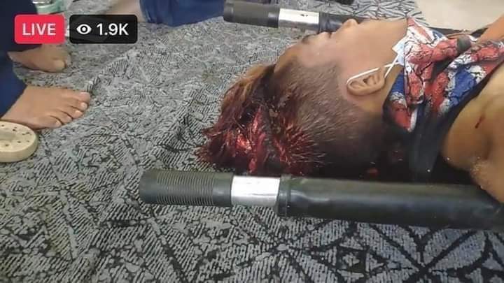 JosephKyaw3's tweet photo. tw//bleeding
Today in Mandalay, the military shot at the people with real bullet. This kid was shot through the head and in brain dead. Help us. They starts violence.
SUPPORT CRPH
#Feb20Coup
#WhatsHappeningInMyanmar https://t.co/2DwSjavNQ6 https://t.co/xmakWJEwcx