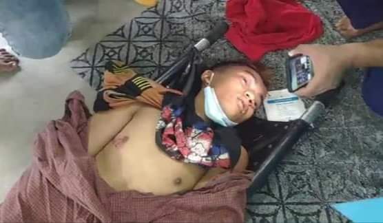 Pwk_26's tweet photo. Breaking News: A young man was shot dead in Mandalay by police and army.

မန္တလေးတွင် ရဲနှင့်စစ်တပ်၏ အကြမ်းဖက်ပစ်ခတ်မှု​ကြောင့် လူငယ်တစ်ဦး ဦး​ခေါင်းပွင့်ထွက်၍ ​သေဆုံးသွားခဲ့ရ​ကြောင်းသိရှိရသည်။

Rest in peace 💔
PRAY FOR MANDALAY 😭🙏🏻

#Feb20Coup 
#WhatsHappeningInMyanmar https://t.co/OX9ajY6hvD