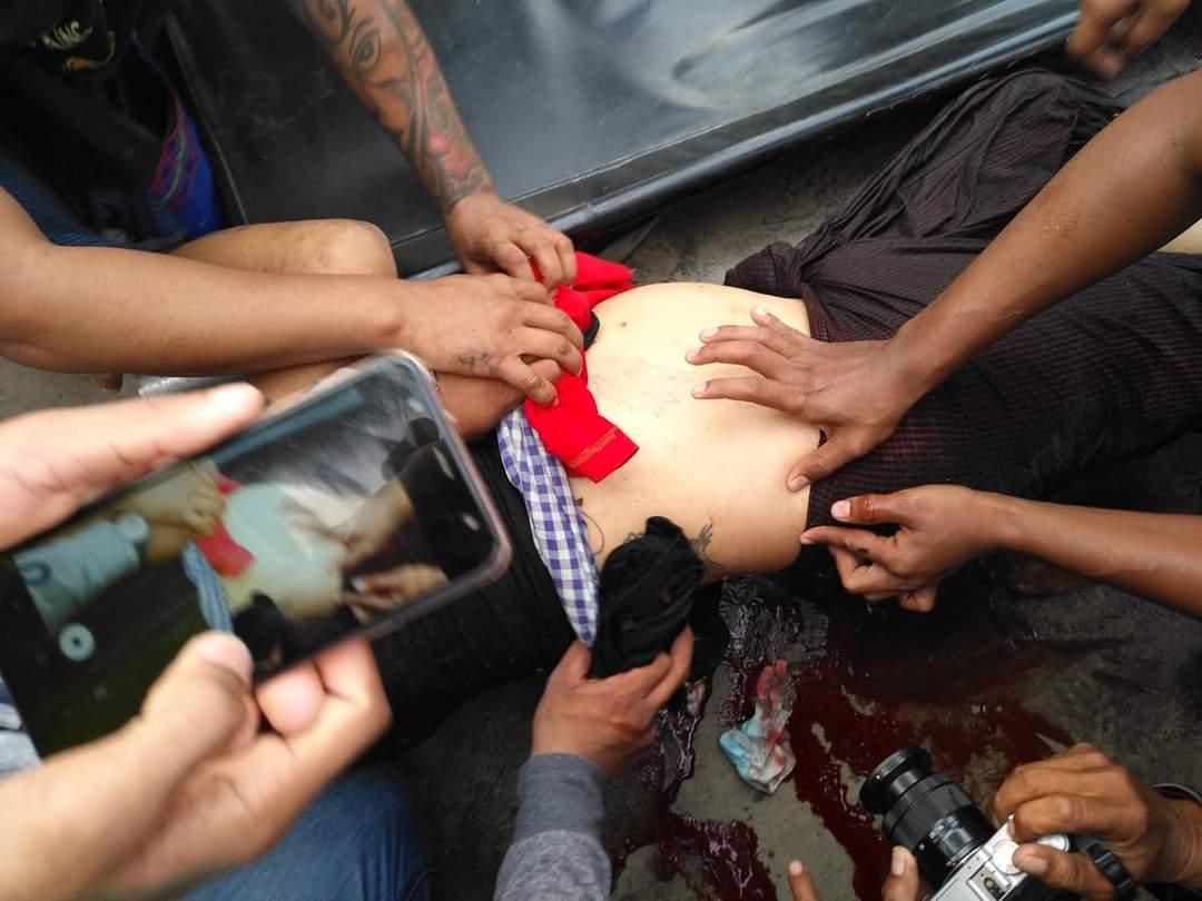<a href="/ChangThaw/">Chang Mya Mya Thaw</a> Today(20/02/2021)in Mandalay the police shot the peaceful protesters with real bullets.We are like living in the hell.
TW:blood and violence
#Feb20Coup
#WhatsHappeningInMyanmar
