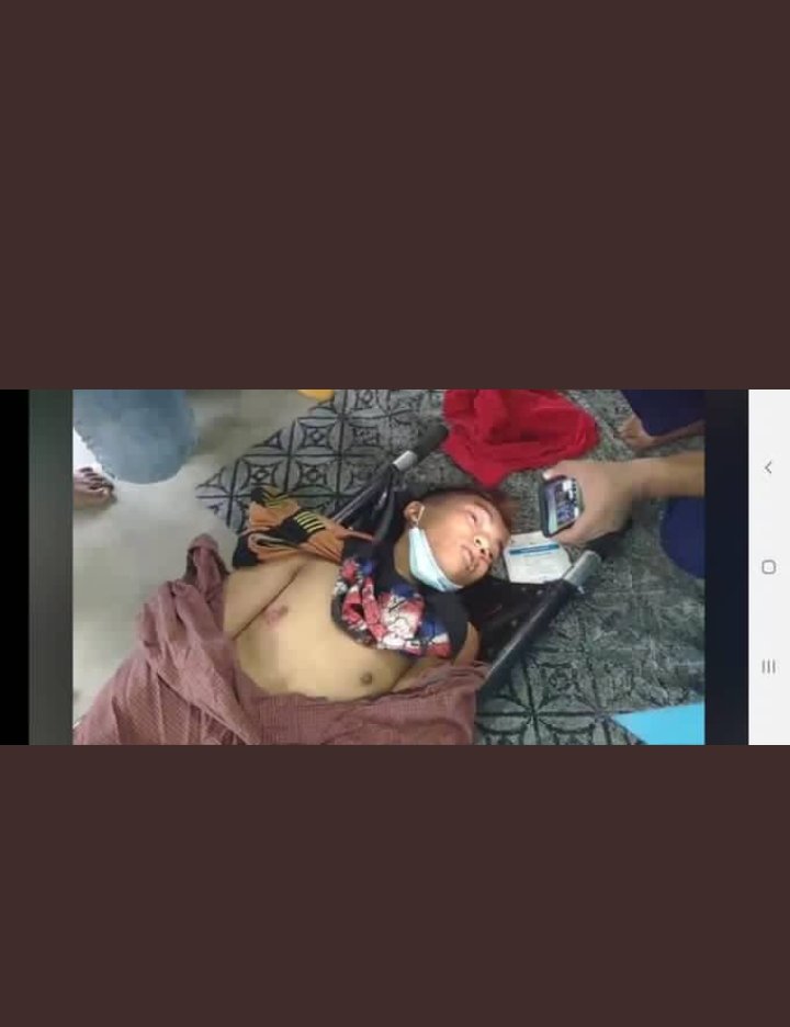 TW:blood and injuries 
This boy's head was shot by real bullet and he lost his life. We protested peacefully.We need justice. We can't tolerate Myanmar military's brutality. Please spread this. 
#WhatsHappeningInMyanmar
#Feb20Coup
