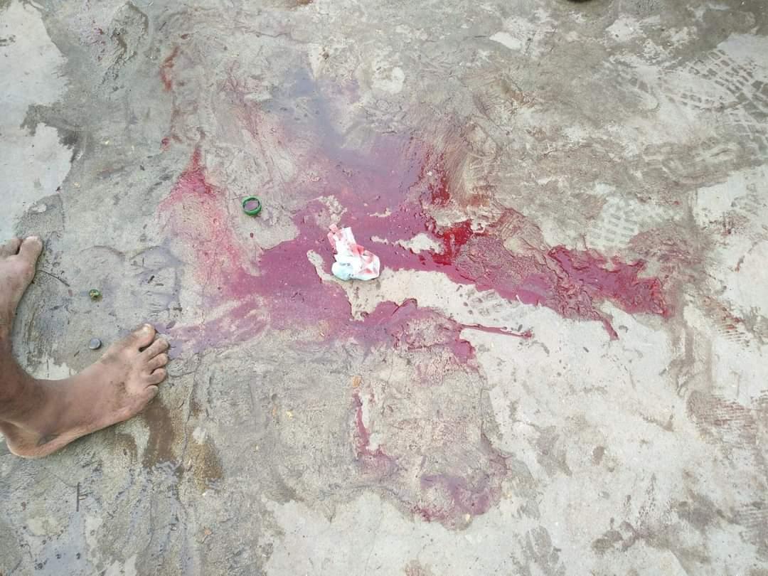 PhyoMyatPan1's tweet photo. These are the photos of a man who got hurt today in Mandalay’s violence acted by police. People say he isn’t in good shape. 

@freya_cole
@YourAnonCentral
@RapporteurUn
#Feb20Coup
#WhatsHapppeningInMyanmar #CrimeAgainstHumanity https://t.co/6cuLoIxLgS