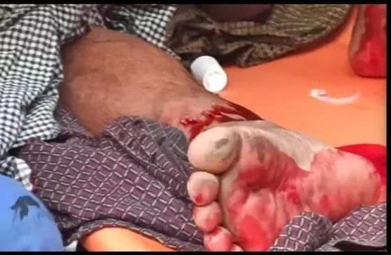 The military brutally terrorizing UNARMED Citizens who were peacefully supporting CDM workers at Yadanarpon Harbour ,Mandalay by using caltrop!
#WhatsHappeningInMyanmar
#Feb20Coup
