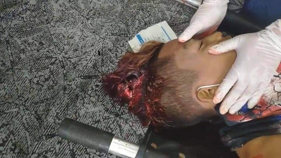 Pwk_26's tweet photo. Myanmar riot police shot gunfires &amp; other dangerous materials like welded screws to disperse the rallies at Yadanarpon Dock. This is the picture of a young boy who died in this crackdown due to head explosion by gunshot.
Save MANDALAY 🙏🏻
 #WhatsHappeningInMyanmar #Feb20Coup https://t.co/v6wZR2CRi9