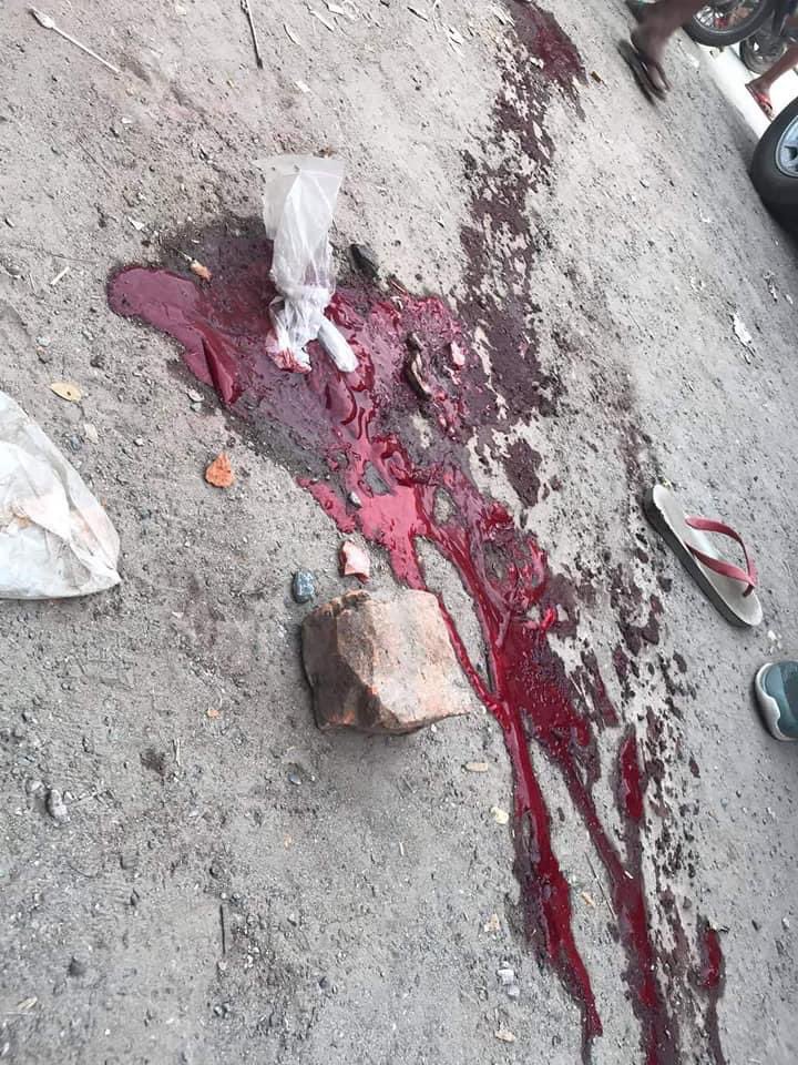 mya_tdtay's tweet photo. In Mandalay, The two protesters were killed and so many protesters injured by the military and polices .They shoot continuously even the ambulance cars and don’t let us to pick up injured people .Military arrested many people including injured people.#WhatsHappeningInMyanmar https://t.co/PuS9n9yTxX