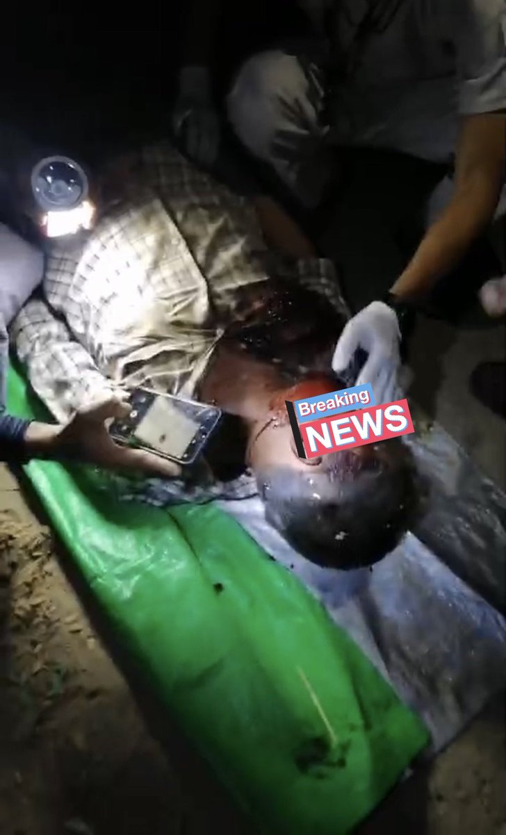 TW// Blood and Dead 

Another Headshot in Shwe Pyi Thar, Yangon. A man was shot in head by Military and died while guarding his street from invasion of Thugs ordered by Military. They aren't Soldiers, they are murderers!

#Feb20Coup
#WhatsHappeningInMyanmar