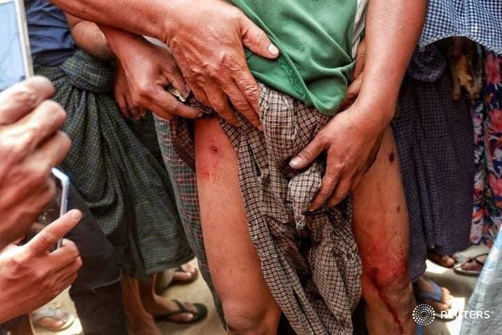 NariPhyo's tweet photo. Inhuman armed forces now using dangerous weapons during quelling demo in Mandalay. They throw iron spikes &amp; stones into the crowd &amp; fire real bullets &amp;tear gas too. Police r practisting these cruel illegal ways in quelling demo.
TW// Wound Blood 
SUPPORT CRPH

 #Feb20Coup https://t.co/irkuxdXQGQ