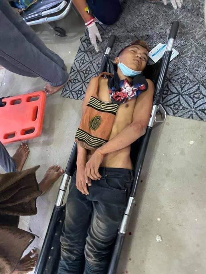 Myanmar army and policemen kilking citizens.  This guy is dead by sniper 
#WhatsHappeningInMyanmar 
#Feb20Coup
