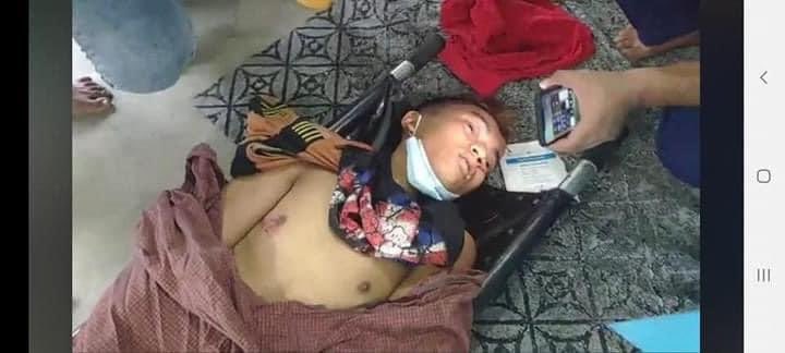 daisy_suu's tweet photo. We lose our lives again today! Myanmar Junta used real bullets! #Mandalay #Feb20Coup https://t.co/UCSglp5ehL