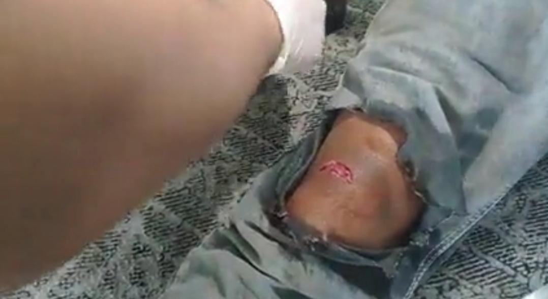 kissyassy's tweet photo. #SaveMyanmar
#WhatsHappeningInMyanmar
#Feb20Coup 
TW: blood, death https://t.co/wxi9WpYWwq