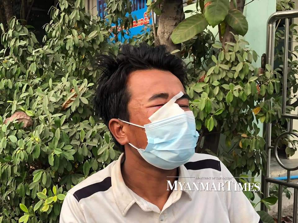 MPoekg's tweet photo. @Ronan_Lee @ChoMiKhine2 #WhatsHappeningInMyanmar
At least seven people were killed and 50 were injured as police and soldiers used live ammunition while attacking peaceful protesters near a shipyard in Mandalay on Saturday afternoon. 
#SaveMyanmar
#Feb20Coup
#InMandalay https://t.co/eGG3M4Ojwu https://t.co/0Db74gxkLr
