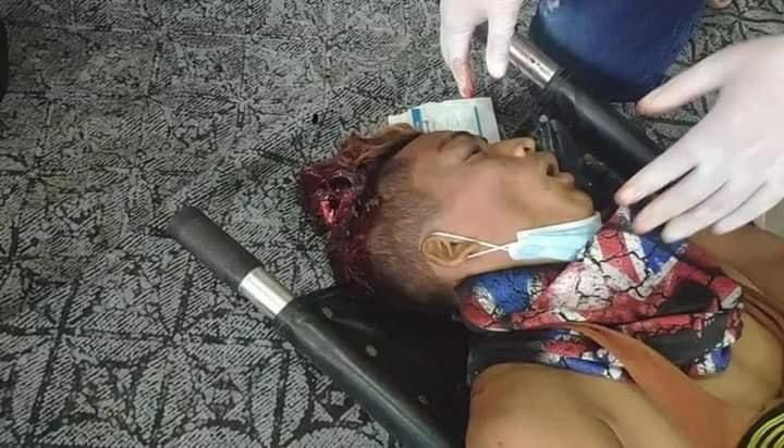 AyeChan1601's tweet photo. In Mandalay, a young man’s brain was exploded after being shot by police and army and died immediately on feb 20 Demo crack-downs.

TW // Wound 

SUPPORT CRPH

#Feb20Coup
#WhatsHappeningInMyanmar https://t.co/2z7solQokR
