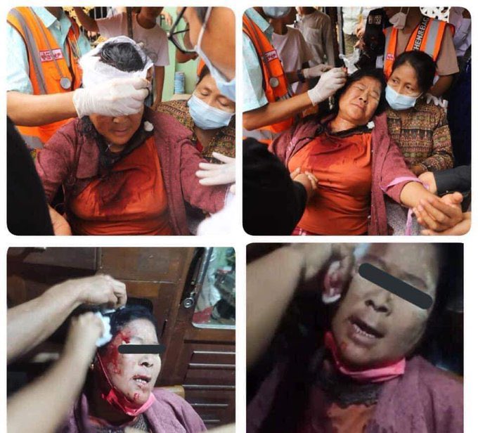TW // GUNSHOT and BLOOD and DEATH and VIOLENCE One of the peaceful protesters in Mandalay was shot to death by police ‼️ <a href="/UN/">United Nations</a> #WhatsHappeningInMyanmar #Feb20Coup #HearTheVoiceOfMyanmar #CrimesAgainstHumanity