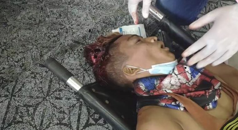 Myanmar military fire with real bullets to protesters against dictatorship. 
#SaveMyammar 
#Mandalay 
#WhatsHappeningInMyanmar