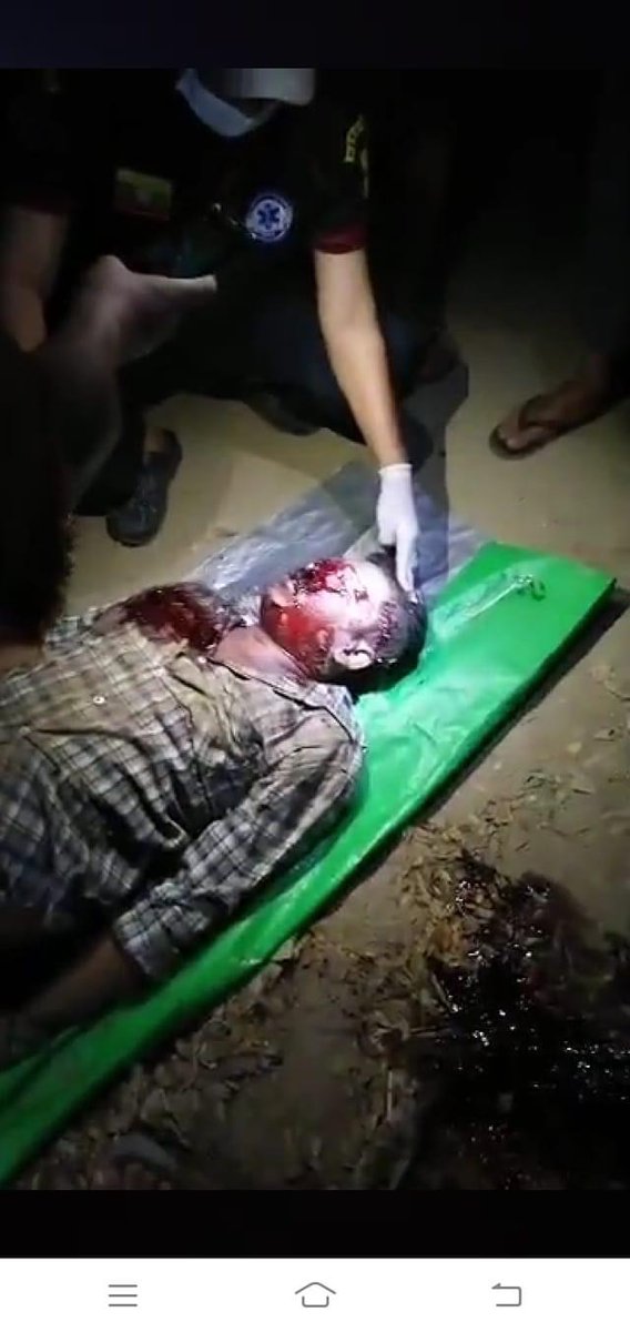 Pencilo4's tweet photo. A man just died with a headshot by the military in Yangon 

TW// Blood Wound

SUPPORT CRPH

#Feb20Coup
#WhatsHappeningInMyanmar https://t.co/SAF3gWqr4Y