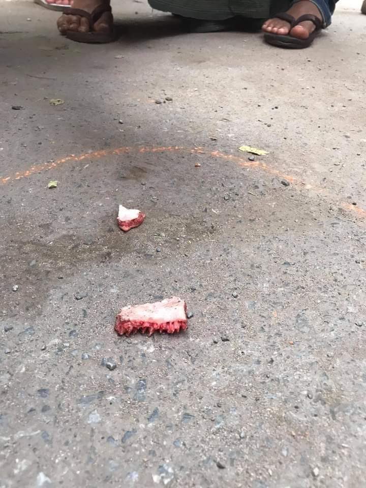 eishwesinphyoe's tweet photo. In Mandalay, a young man’s brain was exploded after being shot by police and army and died immediately on feb 20 Demo crack-downs.
TW// Wound 
SUPPORT CRPH
#Feb20Coup
#WhatsHappeningInMyanmar https://t.co/lCfv2SBXZG