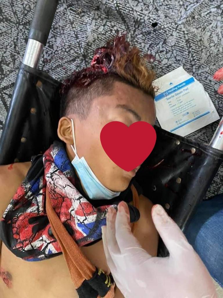 Poeei27's tweet photo. In Mandalay port,the people were shot by military with the real bullets.
So many people were died and hurt.
#HearTheVoiceOfMandalay
#SaveMyanmar
#20febcoup https://t.co/H9wFZIc1W7