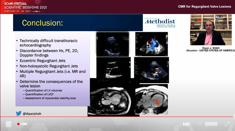 CMR expert & my mentor @DipanJShah presents CMR for regurgitant Valve lesions ✅MR quantification not affected by multiple jets, eccentricity and cardiac cycle timing. ✅Anatomic orifice area ✅Mechanism & valve morphology ✅Myocardial fibrosis #SCMR2021 @SCMRorg @HMethodistCV