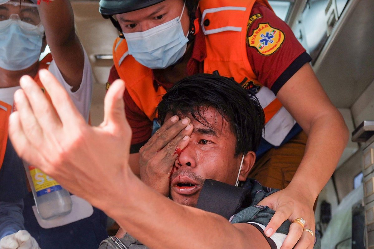 Samhon852's tweet photo. 緬甸軍方血腥鎮壓反政變示威　據報逾 300 次射擊至少 2 死　男童疑被實彈爆頭
https://t.co/XJEU9xAOEK
一名男童被抬上擔架搶救，其頭殼毀爛，當地民眾指他被子彈擊中，但未知是實彈還是橡膠子彈。

相片所見��現場不少民眾拾���彈殼拍照，顯示不少均為實彈。 https://t.co/eEAufGMFtZ