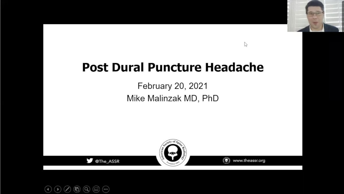 Matthew S. Parsons (@mattparsonsmd) on Twitter photo Saved the best for last for the Headache and the Spine session? “Post-Dural Puncture Headache” by Dr Michael Malinzak from <a href="/DukeRadiology/">Duke Radiology</a>. <a href="/radiology_ninja/">Ichiro Ikuta, MD, MMSc</a> <a href="/PeterGKranz/">Peter Kranz</a> <a href="/The_ASSR/">American Society of Spine Radiology (ASSR)</a> Saved the best for last for the Headache and the Spine session? “Post-Dural Puncture Headache” by Dr Michael Malinzak from <a href="/DukeRadiology/">Duke Radiology</a>. <a href="/radiology_ninja/">Ichiro Ikuta, MD, MMSc</a> <a href="/PeterGKranz/">Peter Kranz</a> <a href="/The_ASSR/">American Society of Spine Radiology (ASSR)</a>