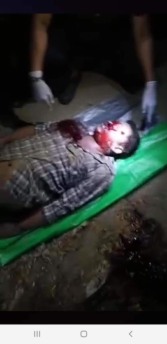 HNwayoo's tweet photo. tw // blood,violence,death.Happening now in shwepyithar,yangon ,Myanmar!The military shot an innocent civilian who’s guarding his neighborhood with real bullets to the head. Who do we call for help when the police themselves are murdering us ? #Feb20Coup #WhatsHappeningInMyanmar https://t.co/NhLVX1t42q