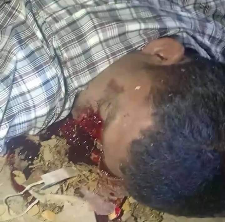 phyominko26jpn's tweet photo. In Yangon, Shwepyithar ward (15), the sentry man asks a passing police car to stop for community security. And then the sentry man was shot in the head by a sniper in a car with four policemen.
#WhatsHappeninglnMyanmar #Coup20Feb 
#yangon
#WhatIsHappeningInMyanmar 
#Feb20Cope https://t.co/uVwtqngBnp