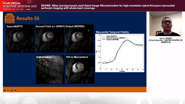 SCMR3Dplus (@scmr3d) on Twitter photo Deep learning based DESIRE sequence presented <a href="/SCMRorg/">Society for Cardiovascular Magnetic Resonance</a> #SCMR2021, highly desirable as it reduces 1st pass perfusion imaging analysis time. Deep learning based DESIRE sequence presented <a href="/SCMRorg/">Society for Cardiovascular Magnetic Resonance</a> #SCMR2021, highly desirable as it reduces 1st pass perfusion imaging analysis time.