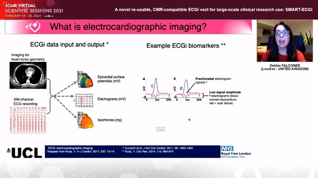 SCMR3Dplus (@scmr3d) on Twitter photo Novel Vest for non-invasive voltage mapping, Smart ECGi <a href="/SCMRorg/">Society for Cardiovascular Magnetic Resonance</a> #SCMR2021 #whyCMR Novel Vest for non-invasive voltage mapping, Smart ECGi <a href="/SCMRorg/">Society for Cardiovascular Magnetic Resonance</a> #SCMR2021 #whyCMR