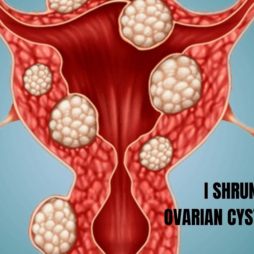 detoxmiracle's tweet photo. I Naturally Shrunk my Complex Ovarian Cyst/Fibroid.  Watch full video.
https://t.co/D1gIVj16xG
Free Salad Ebook. Get your copy via this link
https://t.co/ynEVdoUL6v https://t.co/lED3R7Cv0T